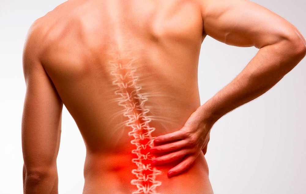 Testimonio - Hernia de Disco Lumbar